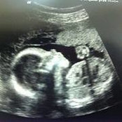 Ellen DeGuire Murray's photo