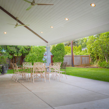 Large Hipped Patio Cover in Albany