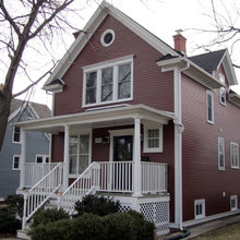 Siding Options