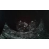 Jacquelyn Kranzs foto