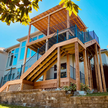 Multi-Level Tiered Deck w/ Pergola