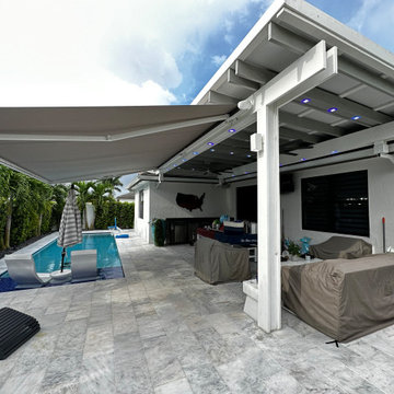 Cassette Retractable Awning