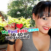 Foto von My First Foto 3D ultrasound