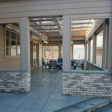 Retractable Flex screens