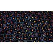 Randie Jaffe's photo