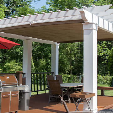 Retractable Shade, Pennsylvania