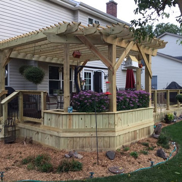 Wood Deck Design with Pergola in Libertyville, IL