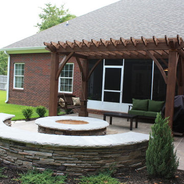 Woodburning Firepit Kit