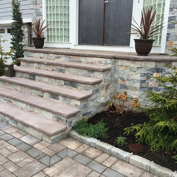 5 Towns Front Makeover