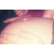 Star Perez's photo
