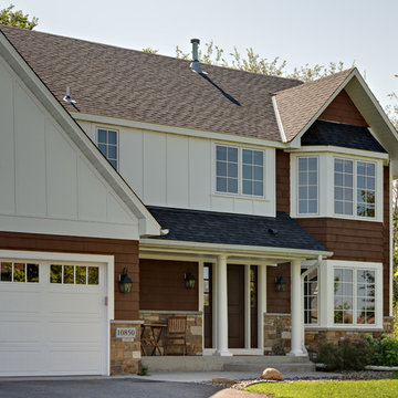 Exterior Facelift