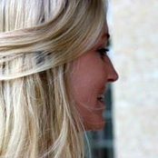 Albane Ltsss billede