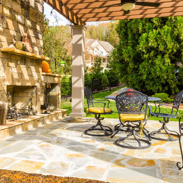Signal Mountain Project | Pergola
