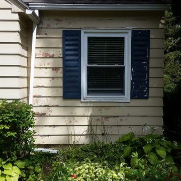 Exterior Face Lift