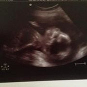 Joshua Pless-Mosley's photo