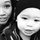 putri_burns