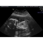 Maury Seitel's photo