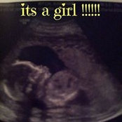 Aviaonne Ritch's photo