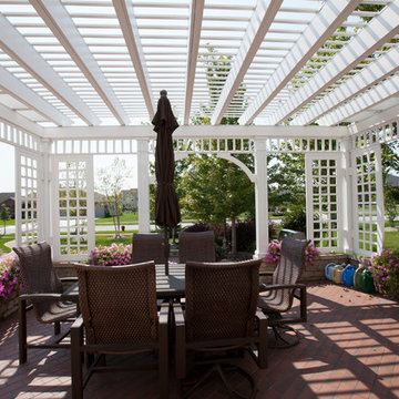 Exterior Remodel; New Pergola