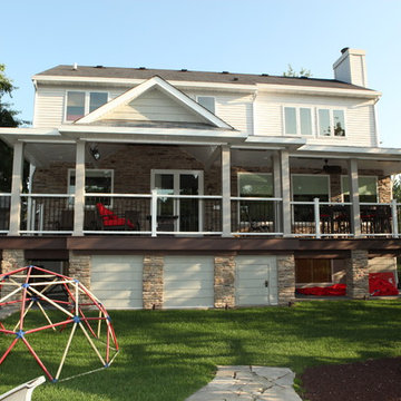Exterior Remodel in Woodridge, IL