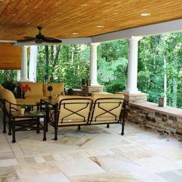 Running Springs Back Landscape Renovation