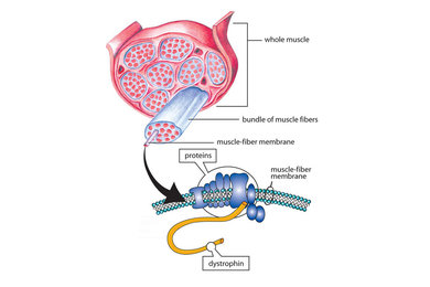 Duchenne Muscular Dystrophy