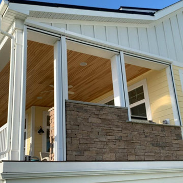 Motorized Zip Tex Retractable Screen System/ Solar Fabric - Edgley