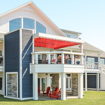 Retractable Shade, Charlottetown