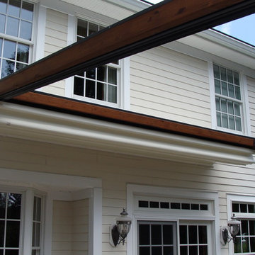 Private Residence, Northern NJ - Retractable Pergola Awning