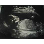 Foto von Trinity Watte'