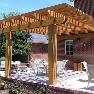 Decks & Pergolas