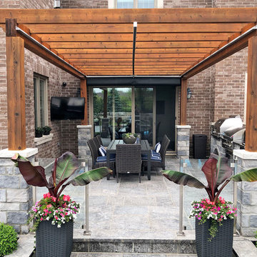 Retractable Shade, King City