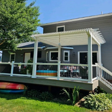 Akron Low Maintenance Deck & Pergola Addition