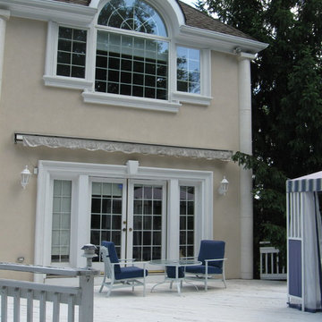 ArcusStone Trim