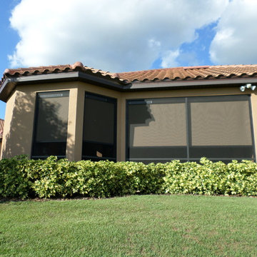 Zip Tex Retractable Privacy Screen