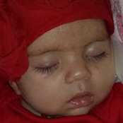 Bernice Solomons billede