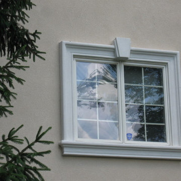 ArcusStone Trim