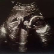 Tenille Grobmyer's photo