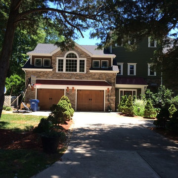 Facelift and addition