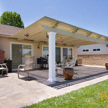 Elitewood Lattice Patio Covers