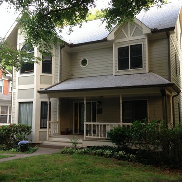 Decatur  GA Face lift