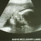 Foto de Phil McCloghry-Laing