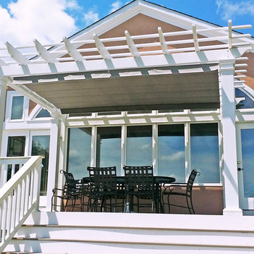 Retractable Shade, Gambrills
