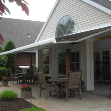 Side by Side Eclipse Premier Retractable Awnings