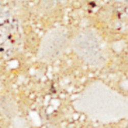 Staron Colors - Kitchen Countertops
