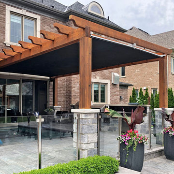 Retractable Shade, King City
