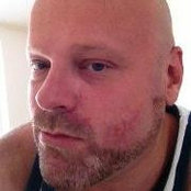 Horst Starks billede