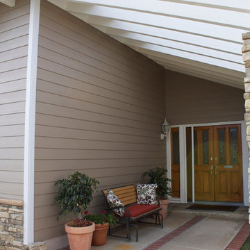Front After view