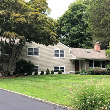 Aesthetic Upgrade in New Canaan, CT