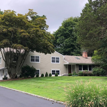 Aesthetic Upgrade in New Canaan, CT